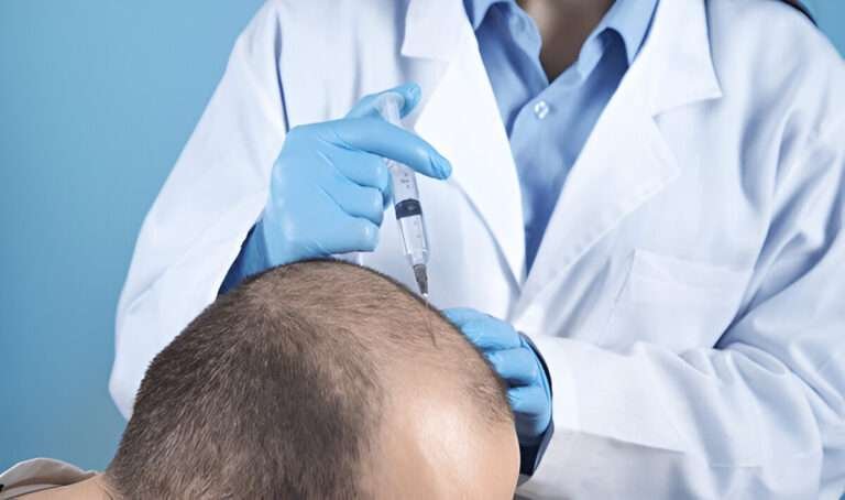 Hair Transplant