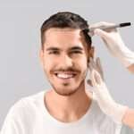 Hair Transplant Options in the UK: What’s Best for You Hair Transplant