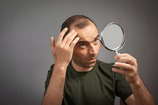 How a Hair Transplant Can Improve Your Self-Esteem Hair Transplant