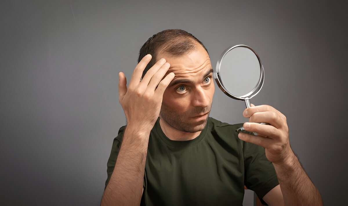 Hair Transplant