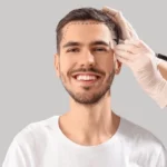 hair loss treatment men