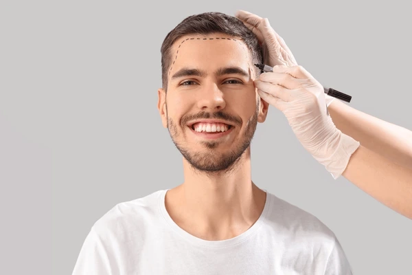hair loss treatment men