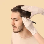 best age for hair transplant
