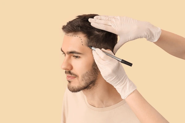 best age for hair transplant