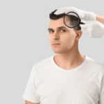 Jude Law hair transplant before and after