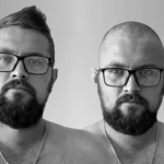 finasteride before and after