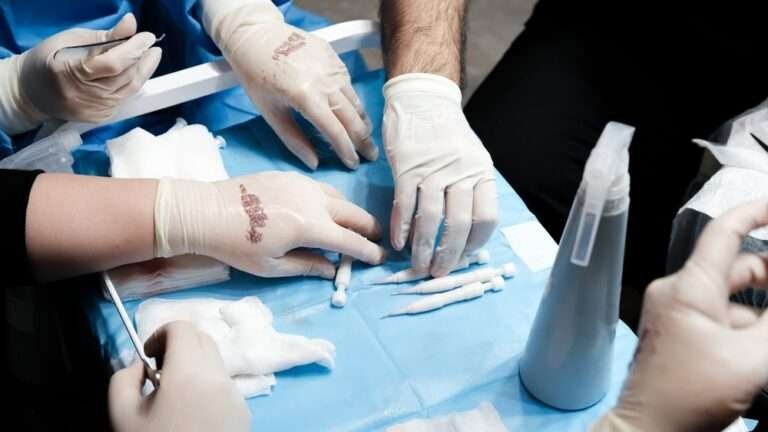 How Much Does a UK Hairline Transplant Really Cost?